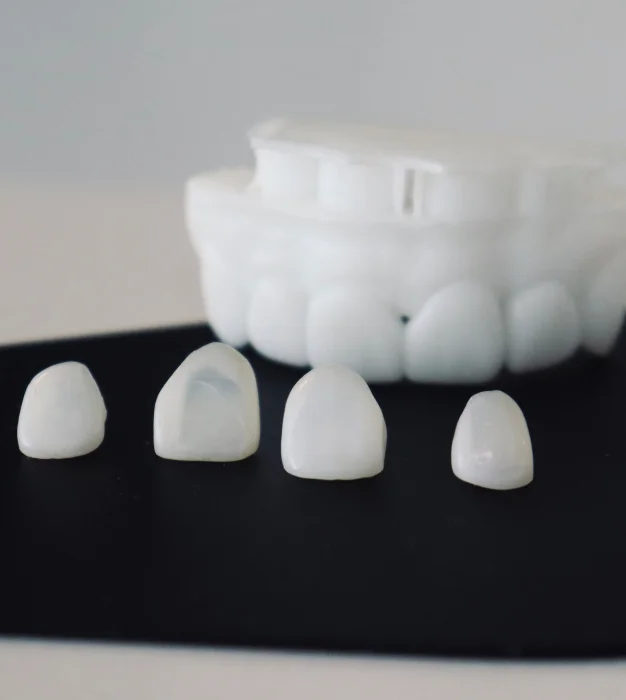 Create the Smile You’ve Always Wanted With Custom Veneers
